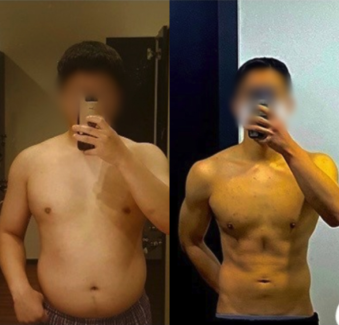 /data/file/before_after/ba_01.jpg