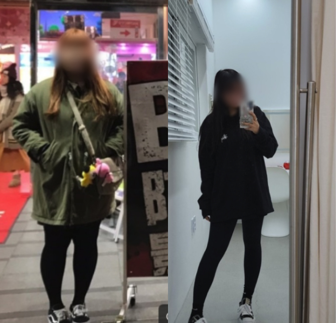 /data/file/before_after/ba_02.jpg