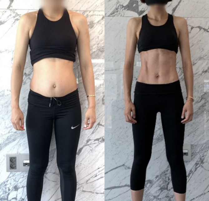 /data/file/before_after/ba_25.jpg