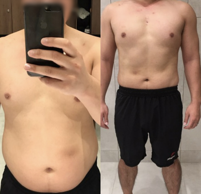 /data/file/before_after/ba_28.jpg