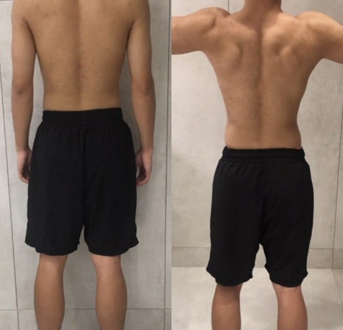/data/file/before_after/ba_29.jpg