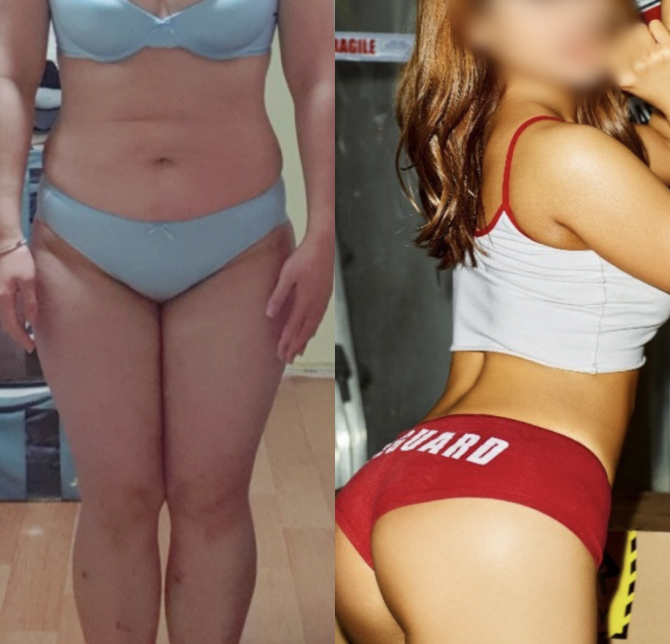 /data/file/before_after/ba_36.jpg