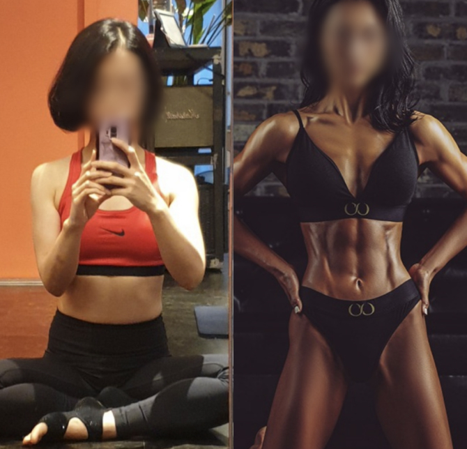 /data/file/before_after/ba_45.jpg